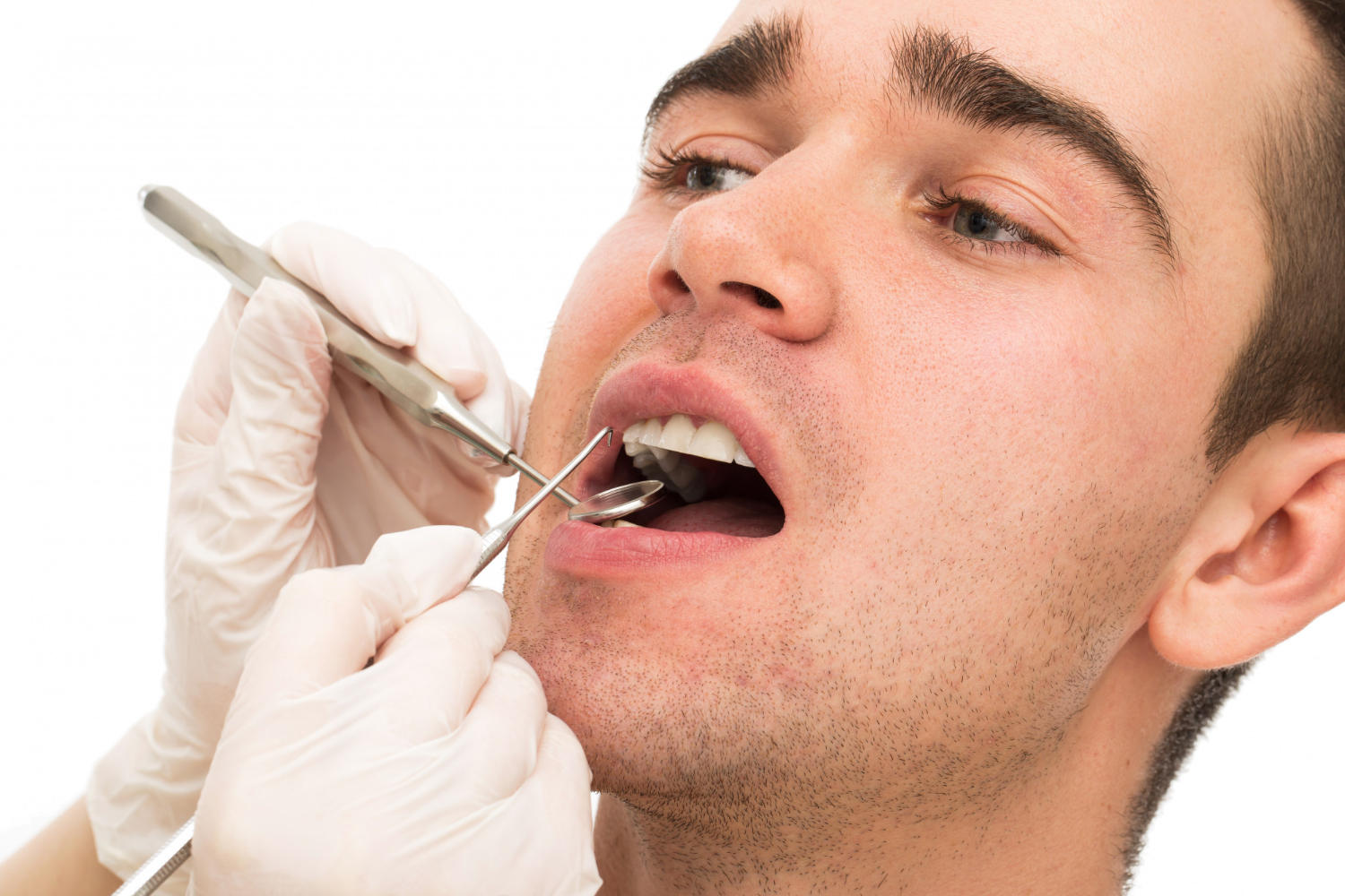 How are chipped teeth repaired