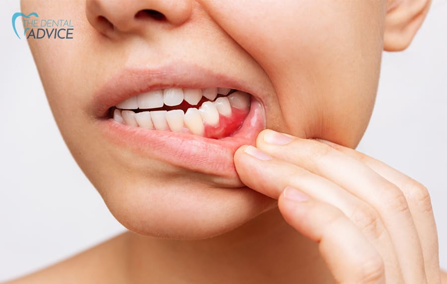 how long until a tooth infection kills you