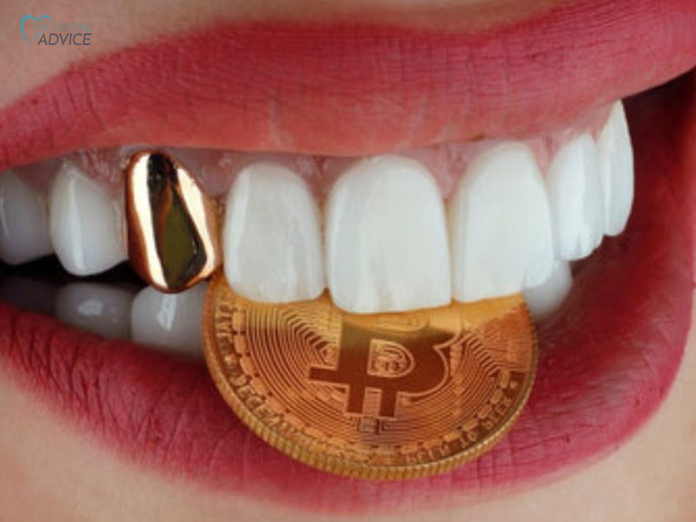 Gold Grillz or Gold Tooth Caps